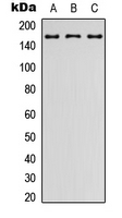 ADGRL2 / LPHN2 Antibody - Western blot analysis of LPHN2 expression in HEK293T (A); Raw264.7 (B); PC12 (C) whole cell lysates.
