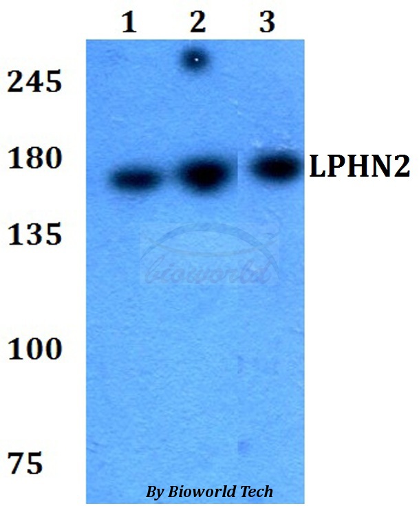 ADGRL2 / LPHN2 Antibody - Western blot of LPHN2 antibody at 1:500 dilution. Lane 1: HEK293T whole cell lysate. Lane 2: Raw264.7 whole cell lysate. Lane 3: PC12 whole cell lysate.