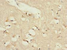 ADGRL2 / LPHN2 Antibody - Immunohistochemistry of paraffin-embedded human brain tissue at dilution 1:100
