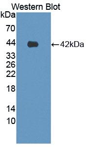 ADGRL3 / LPHN3 Antibody - Western blot of ADGRL3 / LPHN3 antibody using recombinant protein.