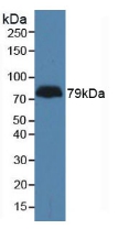 ADGRL3 / LPHN3 Antibody - Western Blot; Sample: Human Serum.