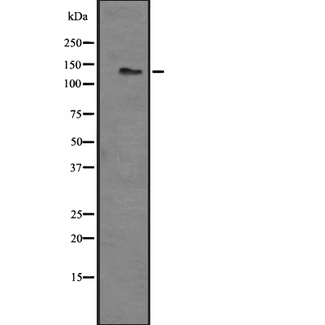 ADGRL3 / LPHN3 Antibody - Western blot analysis of LPHN3 expression in HEK293 cells. The lane on the left is treated with the antigen-specific peptide.