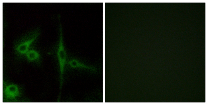 ADGRL4 / ELTD1 Antibody - Immunofluorescence analysis of LOVO cells, using ELTD1 Antibody. The picture on the right is blocked with the synthesized peptide.