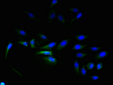 ADGRL4 / ELTD1 Antibody - Immunofluorescent analysis of Hela cells using ADGRL4 Antibody at dilution of 1:100 and Alexa Fluor 488-congugated AffiniPure Goat Anti-Rabbit IgG(H+L)
