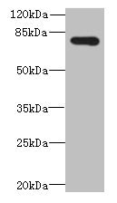 ADGRL4 / ELTD1 Antibody - Western blot All lanes: ADGRL4 antibody at 4µg/ml + Hela whole cell lysate Secondary Goat polyclonal to rabbit IgG at 1/10000 dilution Predicted band size: 78 kDa Observed band size: 78 kDa