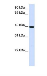 ADH1A / Alcohol Dehydrogenase Antibody - Fetal liver lysate. Antibody concentration: 1.0 ug/ml. Gel concentration: 12%.  This image was taken for the unconjugated form of this product. Other forms have not been tested.