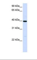 ADH1A / Alcohol Dehydrogenase Antibody - Fetal liver lysate. Antibody concentration: 1.0 ug/ml. Gel concentration: 12%.  This image was taken for the unconjugated form of this product. Other forms have not been tested.