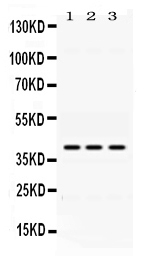 ADH1A / Alcohol Dehydrogenase Antibody - Western blot - Anti-ADH1A Picoband Antibody