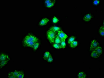 ADH1A / Alcohol Dehydrogenase Antibody - Immunofluorescence staining of HepG2 cells with ADH1A Antibody at 1:66, counter-stained with DAPI. The cells were fixed in 4% formaldehyde, permeabilized using 0.2% Triton X-100 and blocked in 10% normal Goat Serum. The cells were then incubated with the antibody overnight at 4°C. The secondary antibody was Alexa Fluor 488-congugated AffiniPure Goat Anti-Rabbit IgG(H+L).