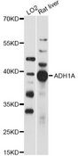 ADH1A / Alcohol Dehydrogenase Antibody - Western blot analysis of extracts of various cell lines, using ADH1A antibody at 1:1000 dilution. The secondary antibody used was an HRP Goat Anti-Rabbit IgG (H+L) at 1:10000 dilution. Lysates were loaded 25ug per lane and 3% nonfat dry milk in TBST was used for blocking. An ECL Kit was used for detection and the exposure time was 30s.