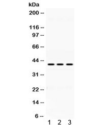 ADH1A / Alcohol Dehydrogenase Antibody - Western blot testing of 1) rat lung, 2) mouse liver and 3) human HepG2 lysate with Alcohol dehydrogenase antibody at 0.5ug/ml. Predicted molecular weight ~40 kDa.