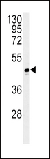ADH1C Antibody - ADH1C Antibody western blot of T47D cell line lysates (35 ug/lane). The ADH1C antibody detected the ADH1C protein (arrow).