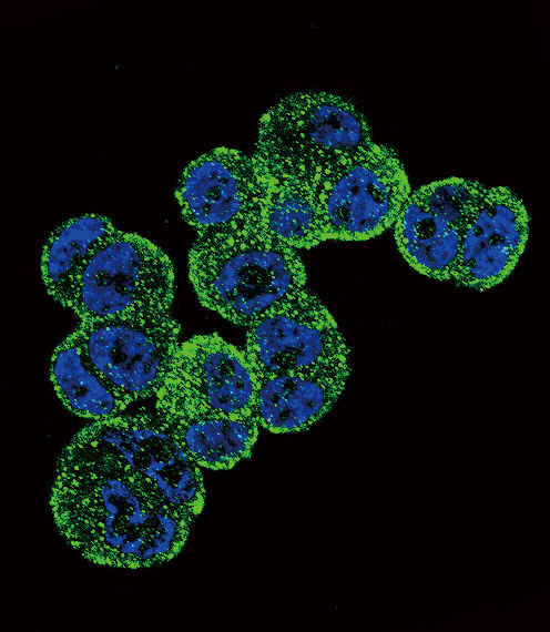 ADH1C Antibody - Confocal immunofluorescence of ADH1C Antibody with T47D cell followed by Alexa Fluor 488-conjugated goat anti-rabbit lgG (green). DAPI was used to stain the cell nuclear (blue).