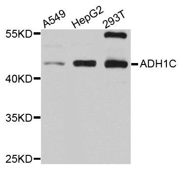 ADH1C Antibody - Western blot analysis of extracts of various cell lines.