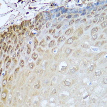 ADH1C Antibody - Immunohistochemistry of paraffin-embedded human esophagus.