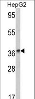 ADH2 / ADH1B Antibody - Western blot of ADH1B Antibody in HepG2 cell line lysates (35 ug/lane). ADH1B (arrow) was detected using the purified antibody.