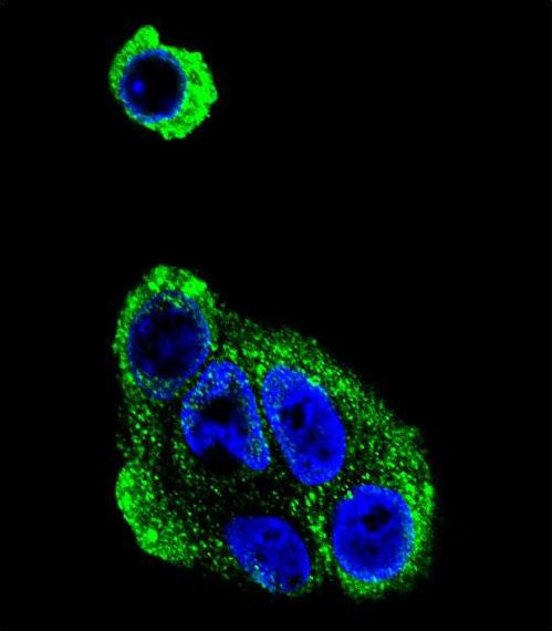 ADH2 / ADH1B Antibody - Confocal immunofluorescence of ADH1B Antibody with HepG2 cell followed by Alexa Fluor 488-conjugated goat anti-rabbit lgG (green). DAPI was used to stain the cell nuclear (blue).