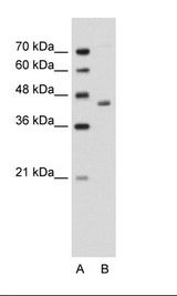 ADH2 / ADH1B Antibody - A: Marker, B: Jurkat Cell Lysate.  This image was taken for the unconjugated form of this product. Other forms have not been tested.