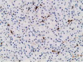 ADH2 / ADH1B Antibody - IHC of paraffin-embedded Human pancreas tissue using anti-ADH1B mouse monoclonal antibody. (Heat-induced epitope retrieval by 10mM citric buffer, pH6.0, 100C for 10min).