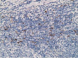 ADH2 / ADH1B Antibody - IHC of paraffin-embedded Human lymph node tissue using anti-ADH1B mouse monoclonal antibody. (Heat-induced epitope retrieval by 10mM citric buffer, pH6.0, 100C for 10min).