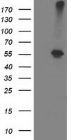 ADH2 / ADH1B Antibody - HEK293T cells were transfected with the pCMV6-ENTRY control (Left lane) or pCMV6-ENTRY ADH1B (Right lane) cDNA for 48 hrs and lysed. Equivalent amounts of cell lysates (5 ug per lane) were separated by SDS-PAGE and immunoblotted with anti-ADH1B.