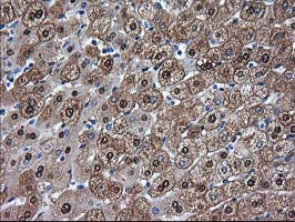 ADH2 / ADH1B Antibody - IHC of paraffin-embedded Human liver tissue using anti-ADH1B mouse monoclonal antibody.