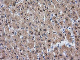 ADH2 / ADH1B Antibody - IHC of paraffin-embedded Human liver tissue using anti-ADH1B mouse monoclonal antibody.