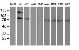 ADH2 / ADH1B Antibody - Western blot of extracts (35ug) from 9 different cell lines by using anti-ADH1B monoclonal antibody.