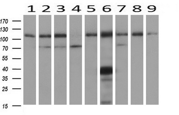 ADH2 / ADH1B Antibody - Western blot of extracts (10ug) from 9 Human tissue by using anti-ADH1B monoclonal antibody at 1:1000 (1: Testis; 2: Omentum; 3: Uterus; 4: Breast; 5: Brain; 6: Liver; 7: Ovary; 8: Thyroid gland; 9: colon).