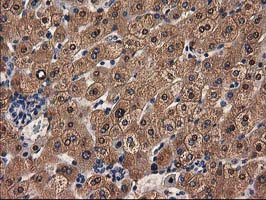 ADH2 / ADH1B Antibody - IHC of paraffin-embedded Human liver tissue using anti-ADH1B mouse monoclonal antibody. (Heat-induced epitope retrieval by 10mM citric buffer, pH6.0, 100C for 10min).
