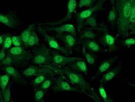 ADH2 / ADH1B Antibody - Immunofluorescent staining of HeLa cells using anti-ADH1B mouse monoclonal antibody.