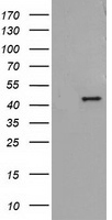 ADH2 / ADH1B Antibody - HEK293T cells were transfected with the pCMV6-ENTRY control (Left lane) or pCMV6-ENTRY ADH1B (Right lane) cDNA for 48 hrs and lysed. Equivalent amounts of cell lysates (5 ug per lane) were separated by SDS-PAGE and immunoblotted with anti-ADH1B.