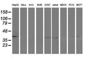 ADH2 / ADH1B Antibody - Western blot of extracts (35 ug) from 9 different cell lines by using anti-ADH1B monoclonal antibody (HepG2: human; HeLa: human; SVT2: mouse; A549: human; COS7: monkey; Jurkat: human; MDCK: canine; PC12: rat; MCF7: human).