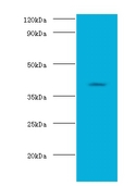 ADH2 / ADH1B Antibody - Western blot of Alcohol dehydrogenase 1B antibody at 2 ug/ml with HepG2 whole cell lysate. Secondary: Goat polyclonal to Rabbit IgG at 1:15000 dilution. Predicted band size: 40 KDa. Observed band size: 40 KDa.  This image was taken for the unconjugated form of this product. Other forms have not been tested.