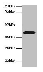 ADH2 / ADH1B Antibody - Western blot All lanes: Alcohol dehydrogenase 1B antibody at 2µg/ml + HepG2 whole cell lysate Secondary Goat polyclonal to rabbit IgG at 1/15000 dilution Predicted band size: 40, 36 kDa Observed band size: 40 kDa