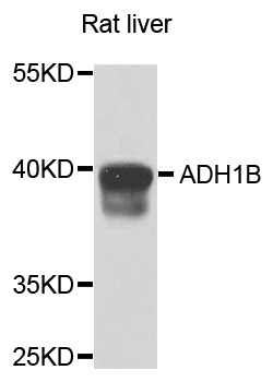 ADH2 / ADH1B Antibody - Western blot analysis of extracts of rat liver cells.