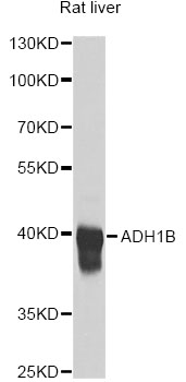 ADH2 / ADH1B Antibody - Western blot analysis of extracts of rat liver, using ADH1B antibody at 1:1000 dilution. The secondary antibody used was an HRP Goat Anti-Rabbit IgG (H+L) at 1:10000 dilution. Lysates were loaded 25ug per lane and 3% nonfat dry milk in TBST was used for blocking. An ECL Kit was used for detection and the exposure time was 30s.