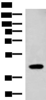 ADH2 / ADH1B Antibody - Western blot analysis of Raji cell lysate  using ADH1B Polyclonal Antibody at dilution of 1:1000