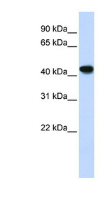 ADH2 / ADH1B Antibody - ADH1B antibody Western blot of Fetal Lung lysate. This image was taken for the unconjugated form of this product. Other forms have not been tested.