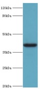 ADH4 Antibody - Western blot. All lanes: Alcohol dehydrogenase 4 antibody at 2 ug/ml+mouse liver tissue. Secondary antibody: Goat polyclonal to rabbit at 1:10000 dilution. Predicted band size: 40 kDa. Observed band size: 40 kDa Immunohistochemistry.