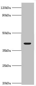 ADH4 Antibody - Western blot All lanes: Alcohol dehydrogenase 4 antibody at 2µg/ml + Mouse liver tissue Secondary Goat polyclonal to rabbit IgG at 1/10000 dilution Predicted band size: 41, 43 kDa Observed band size: 41 kDa