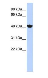 ADH4 Antibody - ADH4 antibody Western Blot of HepG2 cell lysate.  This image was taken for the unconjugated form of this product. Other forms have not been tested.