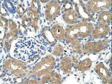 ADH4 Antibody - Immunohistochemistry with Fetal liver cell lysate tissue at an antibody concentration of 1.25 ug/ml using anti-ADH4 antibody.  This image was taken for the unconjugated form of this product. Other forms have not been tested.