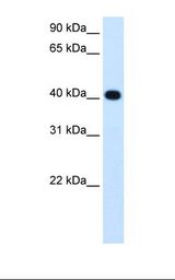 ADH4 Antibody - Fetal liver cell lysate. Antibody concentration: 1.25 ug/ml. Gel concentration: 12%.  This image was taken for the unconjugated form of this product. Other forms have not been tested.