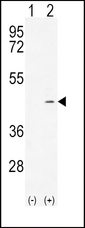 ADH4 Antibody - Western blot of ADH4 (arrow) using rabbit polyclonal ADH4 Antibody. 293 cell lysates (2 ug/lane) either nontransfected (Lane 1) or transiently transfected (Lane 2) with the ADH4 gene.