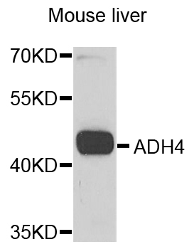 ADH4 Antibody - Western blot analysis of extracts of mouse liver.