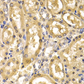 ADH4 Antibody - Immunohistochemistry of paraffin-embedded rat kidney tissue.