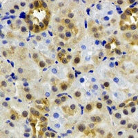 ADH4 Antibody - Immunohistochemical analysis of ADH4 staining in rat kidney formalin fixed paraffin embedded tissue section. The section was pre-treated using heat mediated antigen retrieval with sodium citrate buffer (pH 6.0). The section was then incubated with the antibody at room temperature and detected using an HRP conjugated compact polymer system. DAB was used as the chromogen. The section was then counterstained with hematoxylin and mounted with DPX.