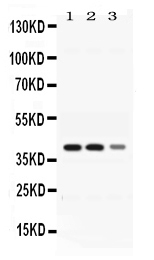 ADH4 Antibody - Western blot - Anti-ADH4 Picoband Antibody