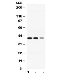 ADH4 Antibody - Western blot testing of 1) rat liver, 2) mouse liver and 3) HepG2 lysate with ADH4 antibody at 0.5ug/ml. Predicted molecular weight ~40 kDa.